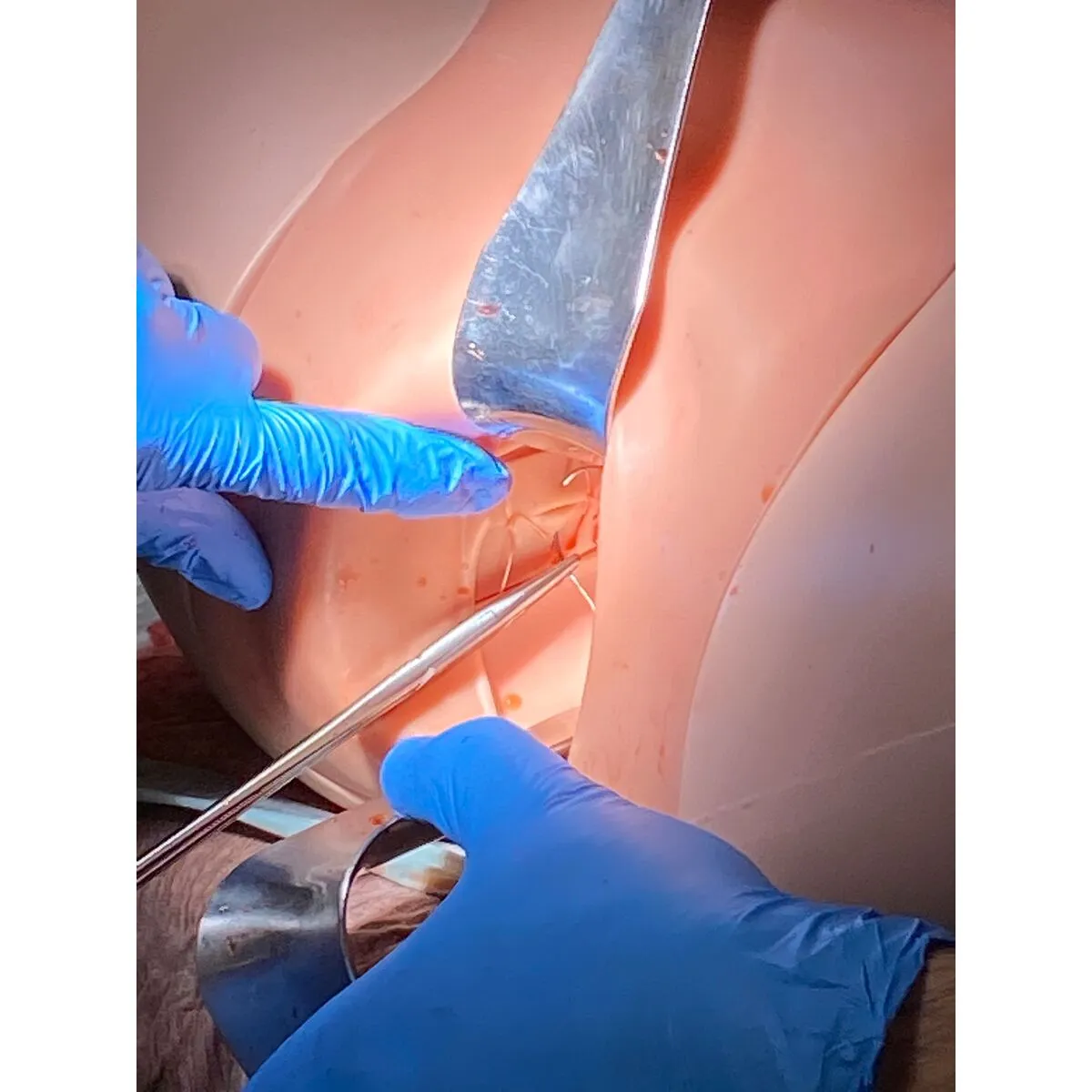 Postpartum Hemorrhage Simulator - PPH Trainer P97 PRO